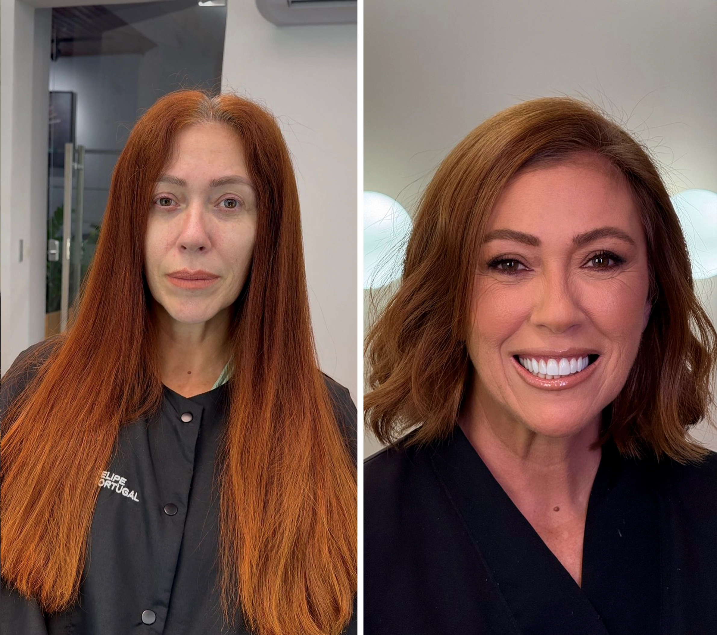 Antes e Depois 6